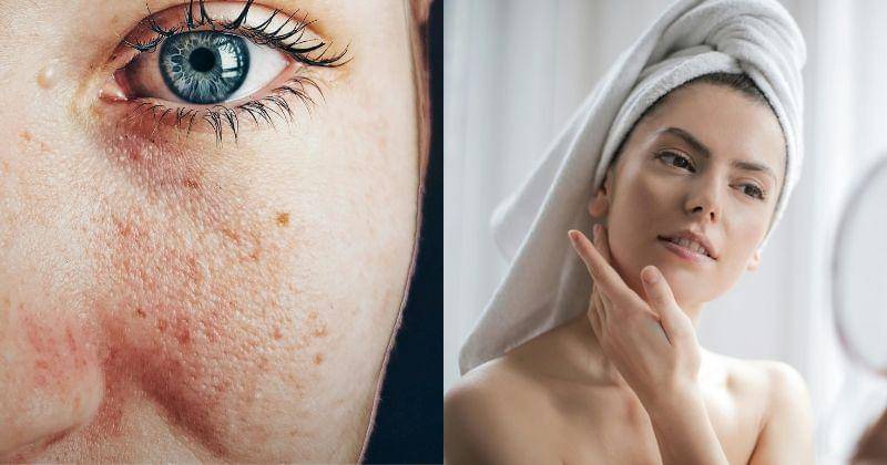 Pexels/Almada Studio, Pexels/Andrea Piacquadio